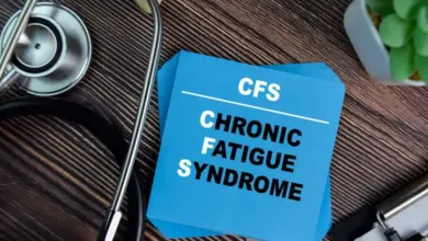 Chronic fatigue syndrome note