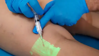 Zdravotník aplikuje sklerozant do žíly nohy pacienta.
