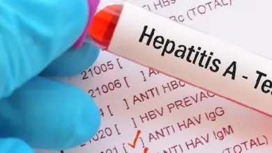 Ruka drží zkumavku s krví pro test hepatitidy typu A.