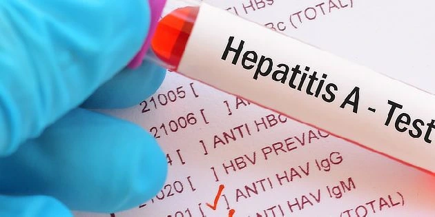 Ruka drží zkumavku s krví pro test hepatitidy typu A.