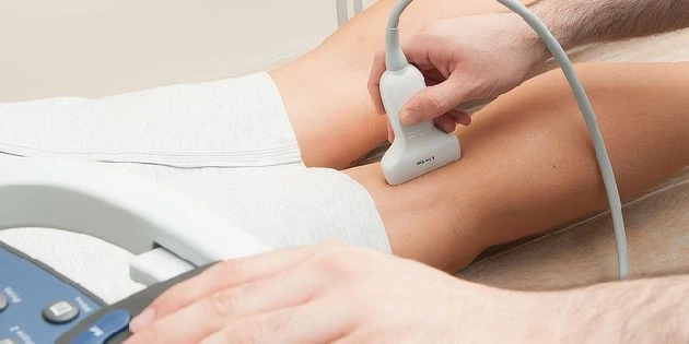 Ultrazvukové vyšetření žil na dolní končetině lékařem.