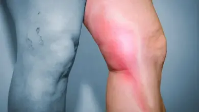 Zdravá noha vedle zánětlivého kolene s červeností.