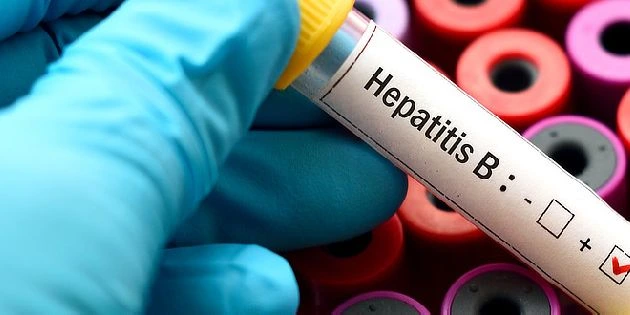 Kladný výsledek krevního testu na hepatitidu B držený rukou.